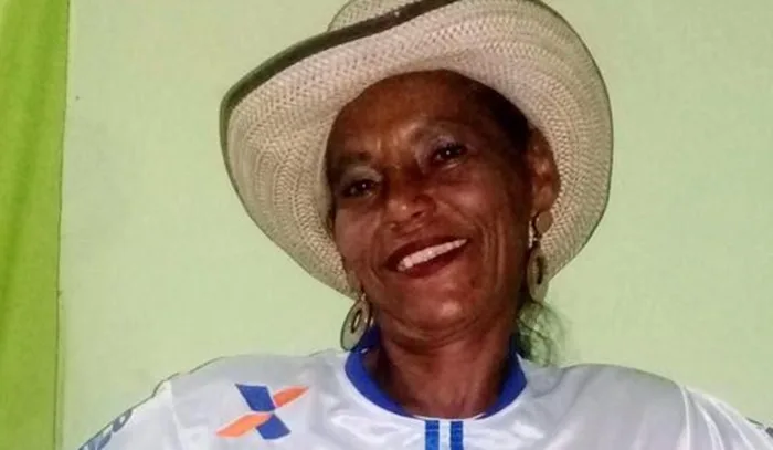 Edna Antônia Araújo dos Santos, que está internada no Hospital ACM - Foto: Arquivo pessoal