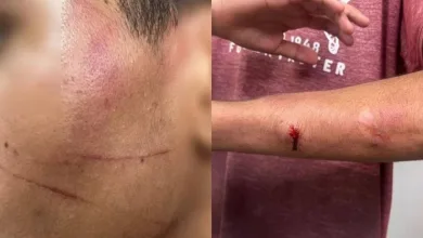 Pai é preso por torturar filhos com facão; "preciso educá-los"