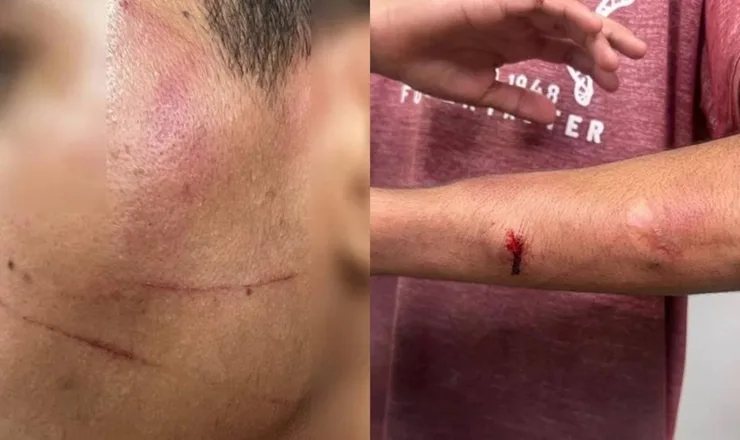 Pai é preso por torturar filhos com facão; "preciso educá-los"