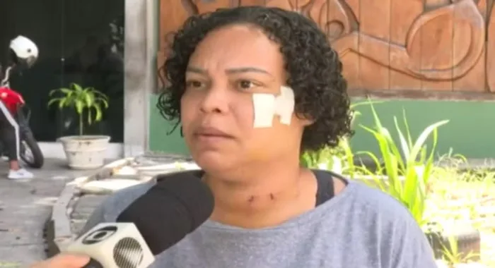 Leonice Vieira foi vítima de tentativa de feminicídio em Salvador — Foto: Reprodução/TV Bahia