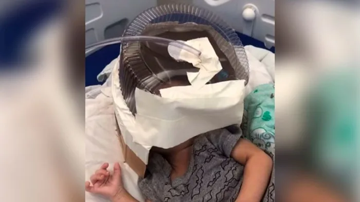 Hospital usa embalagem de bolo como máscara de oxigênio em bebê de 3 meses — Foto: Reprodução