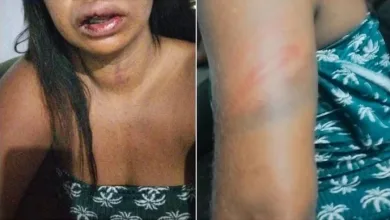 Mulher é agredida por atrasar ao pegar namorado no trabalho — Foto: Arquivo pessoal