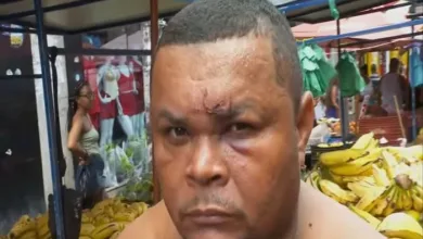 Ambulante acusa Guarda Municipal de agressão durante apreensão de mercadorias - Foto: Reprodução