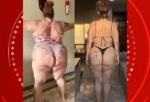 Antes e depois de perder 90 kg com cirurgia bariátrica, Aila Menezes — Foto: Reprodução/Redes Sociais
