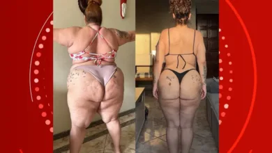 Antes e depois de perder 90 kg com cirurgia bariátrica, Aila Menezes — Foto: Reprodução/Redes Sociais