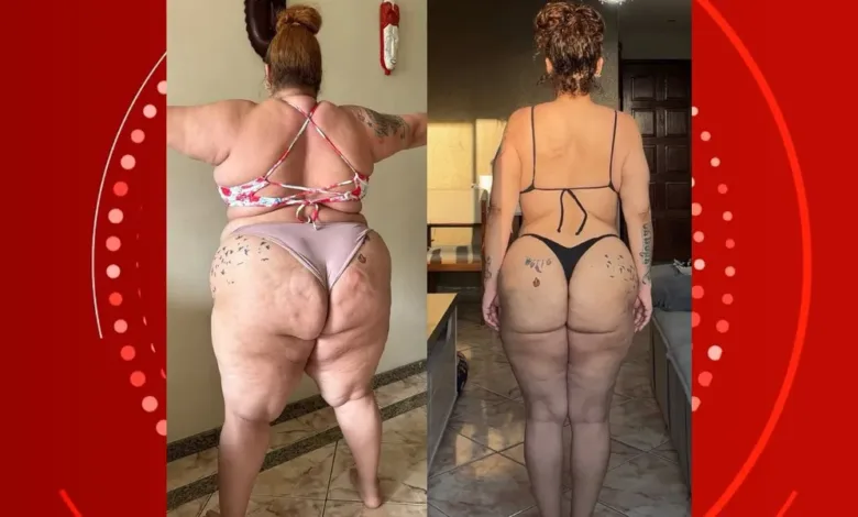 Antes e depois de perder 90 kg com cirurgia bariátrica, Aila Menezes — Foto: Reprodução/Redes Sociais