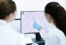 Novo medicamento para linfoma não Hodgkin aprovado pela Anvisa | Foto: Divulgação