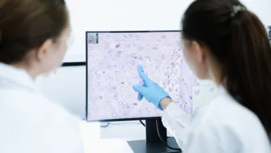 Novo medicamento para linfoma não Hodgkin aprovado pela Anvisa | Foto: Divulgação