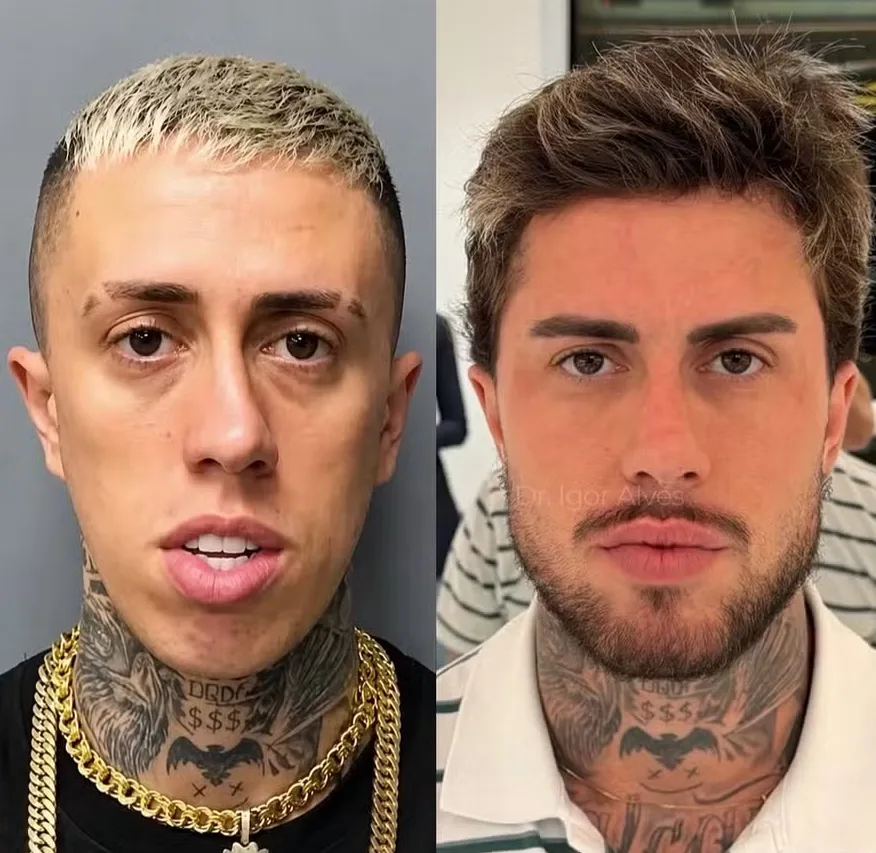 MC Daniel procedimentos estéticos