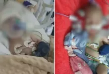 bebê que levou soco permanece internado na UTI | Foto: Reprodução