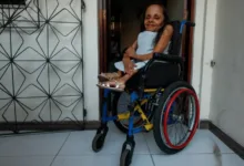 psicóloga com ossos de vidro