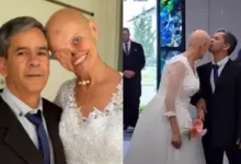 mulher com câncer de pele se casa