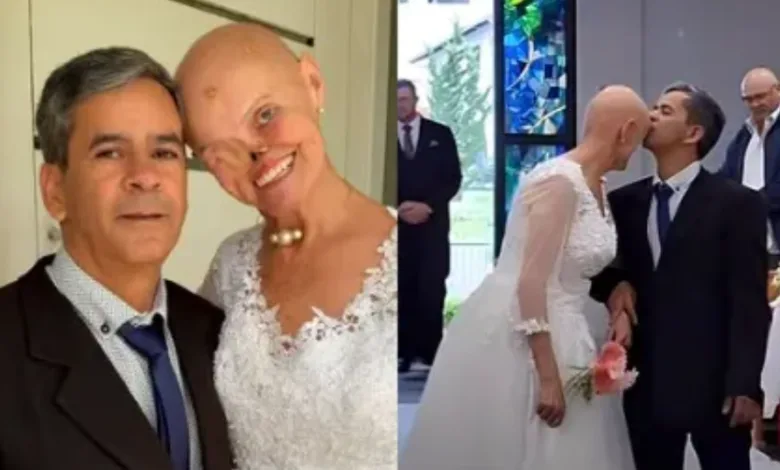 mulher com câncer de pele se casa