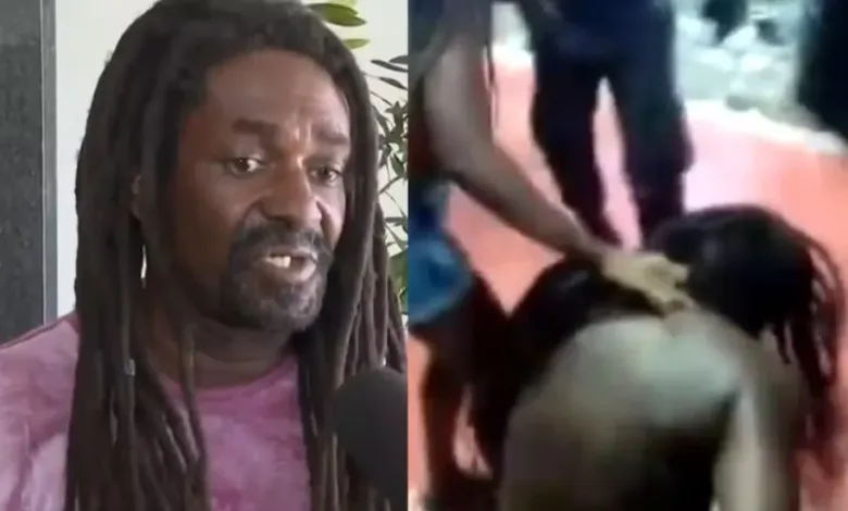 Policial civil agredido no Carnaval de Salvador